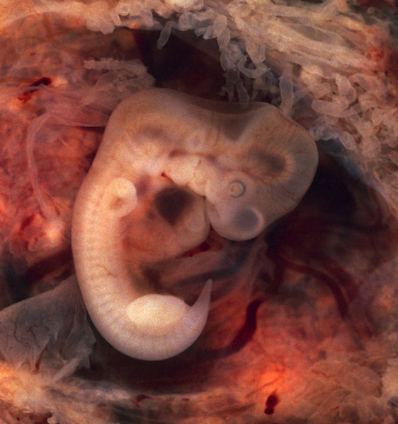 La contaminación química ataca al hombre desde que es un simple embrión